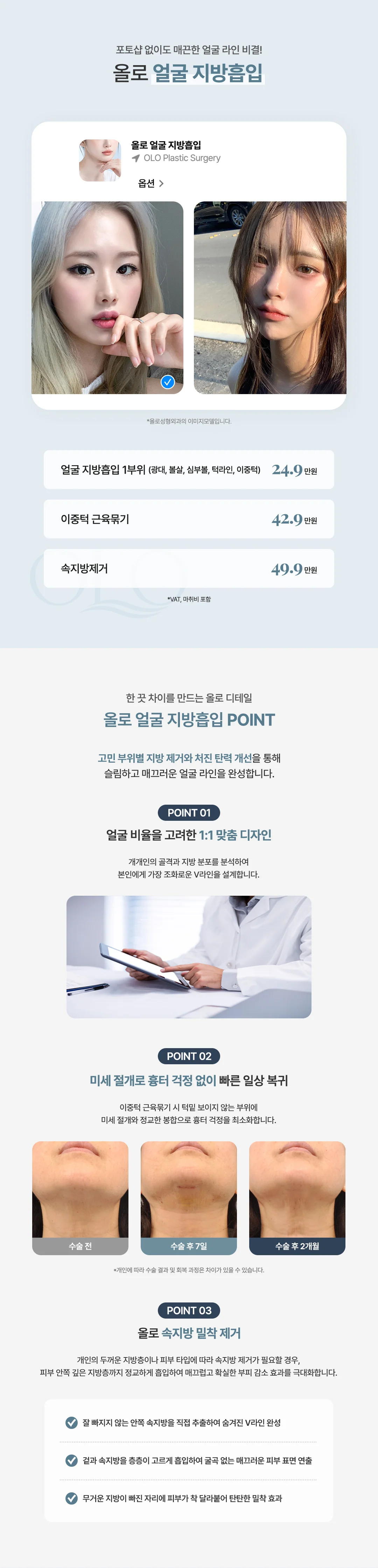올로성형외과 얼굴 지방흡입 시술 안내